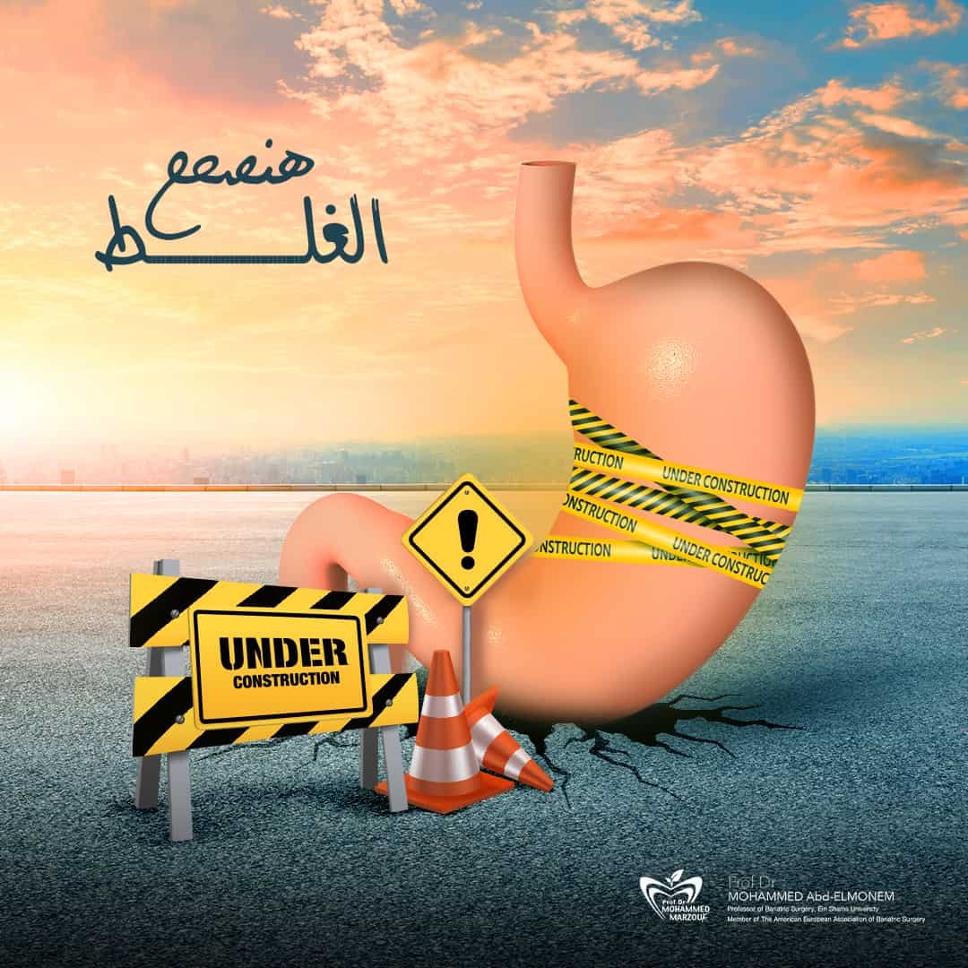 تحويل المسار
